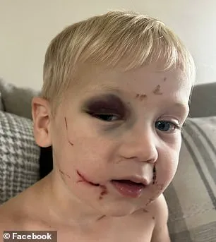 Alleged Beating of One-Year-Old at Georgia Daycare Sparks Outrage and Calls for Regulatory Reform