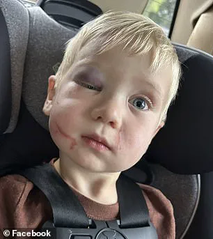 Alleged Beating of One-Year-Old at Georgia Daycare Sparks Outrage and Calls for Regulatory Reform