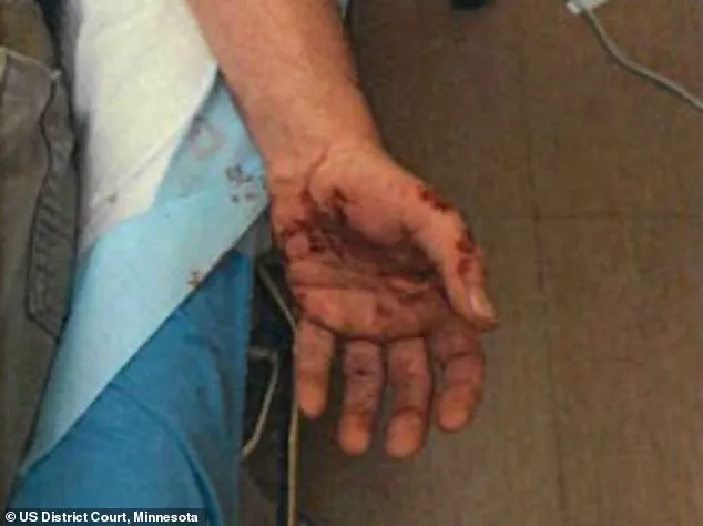 ICE Agent Jonathan Ross Details Past Ordeal in Court, Linking to Fatal Shooting