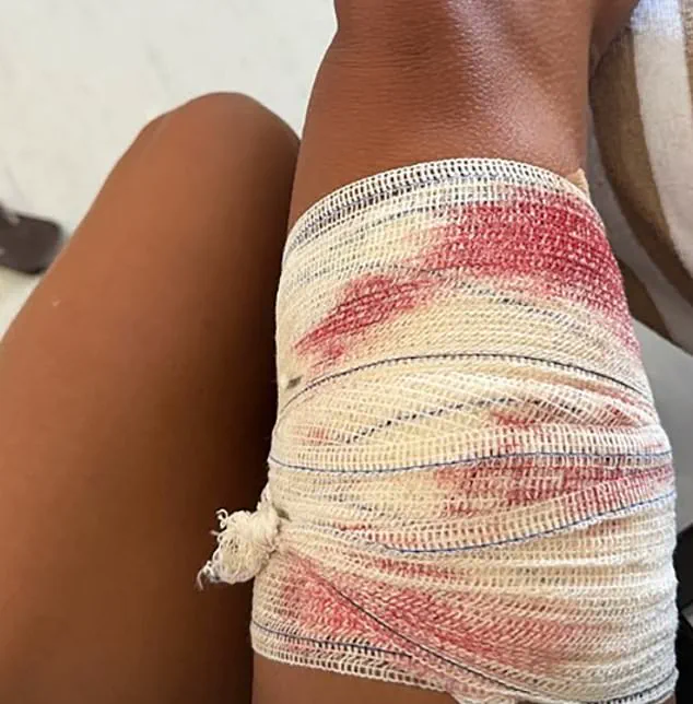 Shark Encounter in UNESCO Site Sparks Calls for Stricter Diving Regulations to Ensure Public Safety