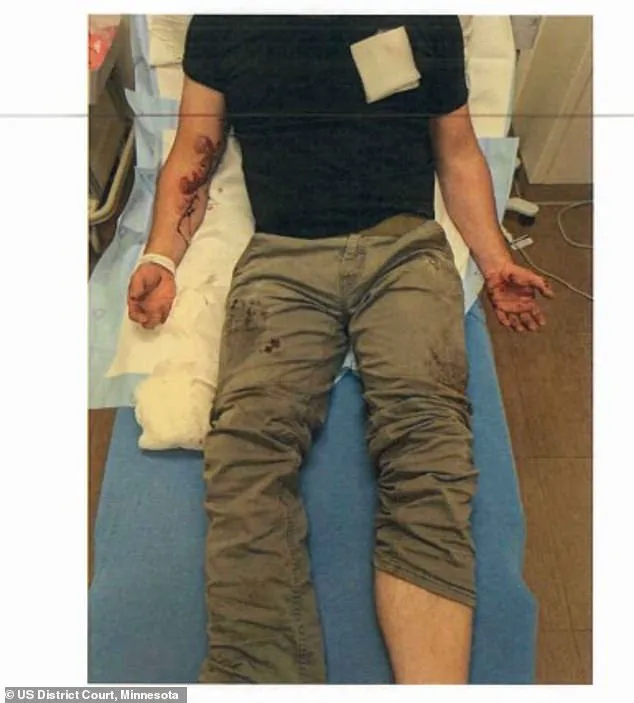 ICE Agent Jonathan Ross's Injuries, Per Two Officials, Spark National Debate Over Federal Enforcement Policies After Confrontation with Renee Nicole Good