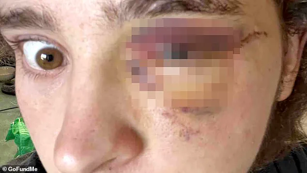 ICE Protest in Santa Ana Turns Violent, Leaving Student's Life in Ruins