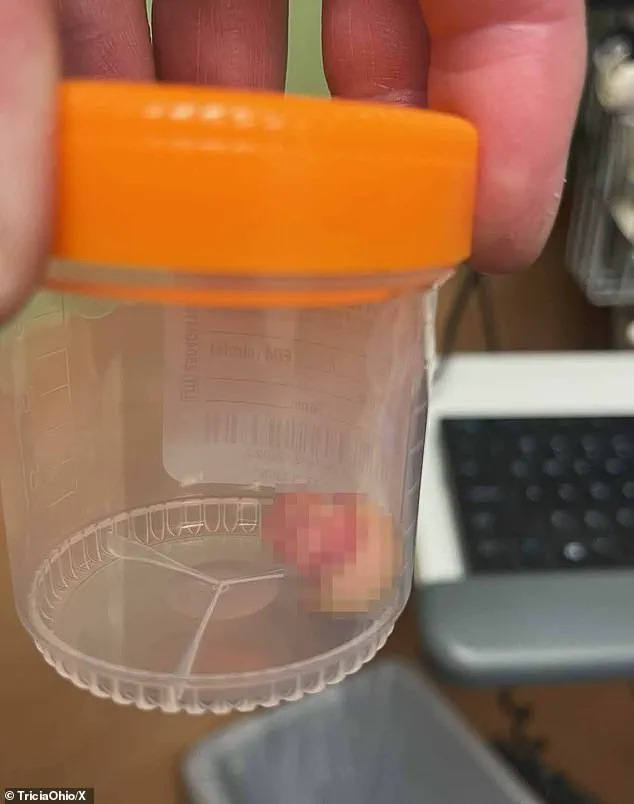 Federal Agent Shooting in Minneapolis Sparks Debate on Government Authority and Public Safety