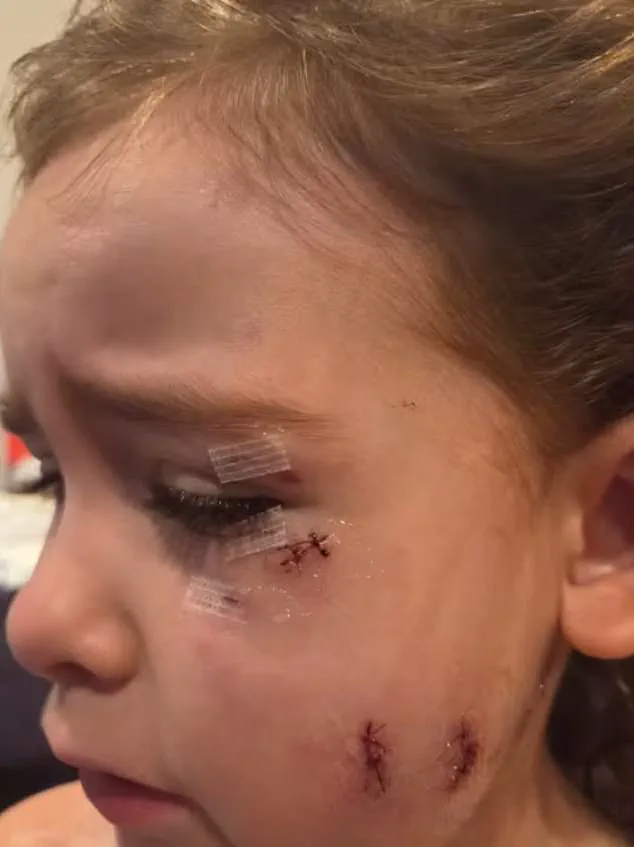 Oshawa Community in Shock After Unleashed Dogs Attack Family