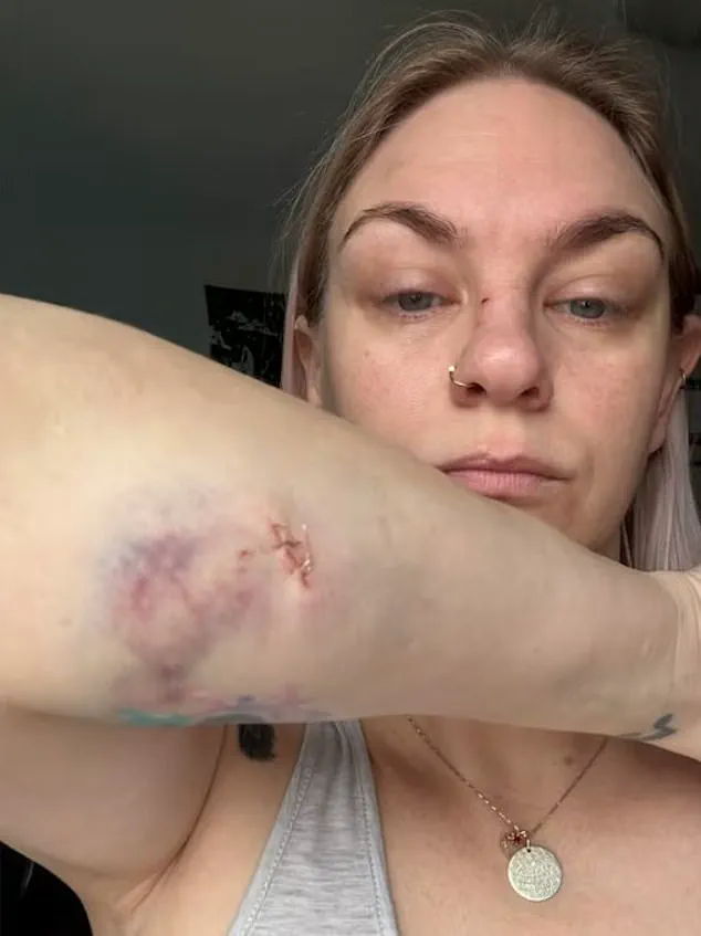 Oshawa Community in Shock After Unleashed Dogs Attack Family
