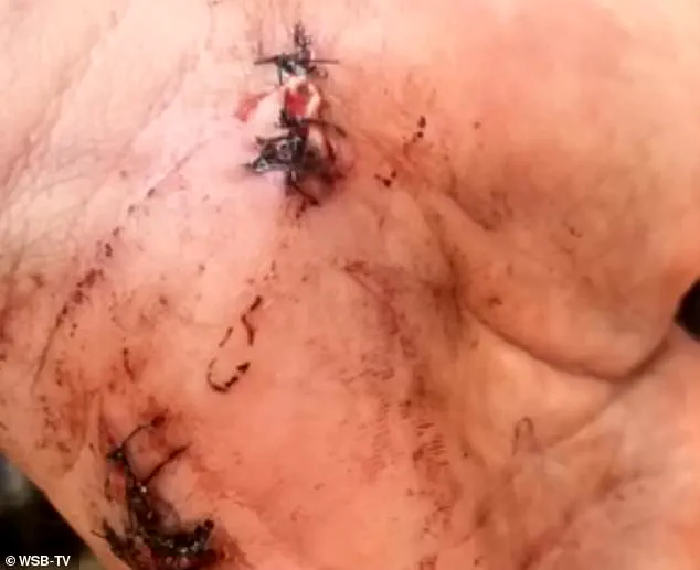 Butts County Legal Firestorm: Murder Charge and Self-Defense Claims Divide Community