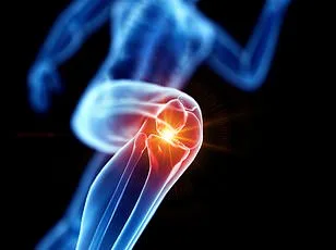 New Therapy Target Identified for Inflammatory Arthritis