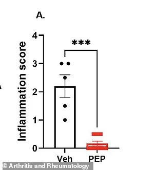 New Therapy Target Identified for Inflammatory Arthritis