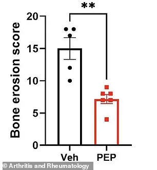 New Therapy Target Identified for Inflammatory Arthritis