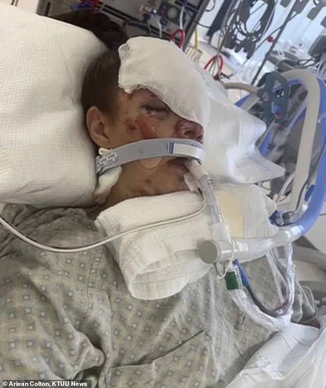 Kenai Mother Reveals Full Severity of Bear Attack Injuries