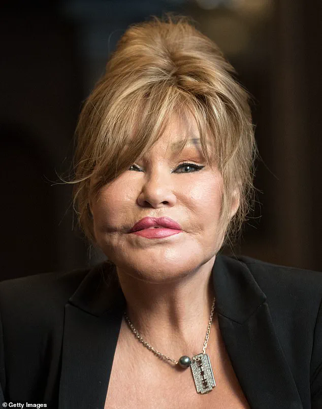 Intimate Photos of Jocelyn Wildenstein Offer Glimpse into Her Personal Life