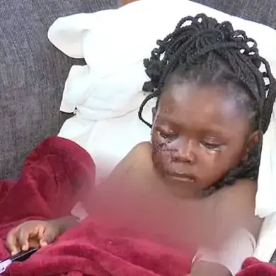 Five-Year-Old Girl Suffers Severe Injuries After Pit Bull Attack in South Bend, Indiana
