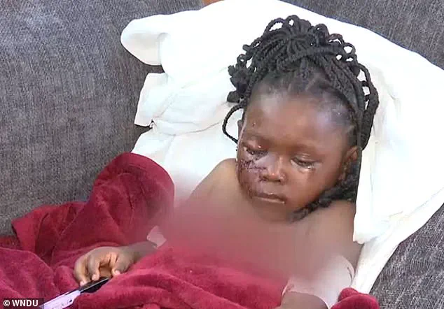 Five-Year-Old Girl Suffers Severe Injuries After Pit Bull Attack in South Bend, Indiana