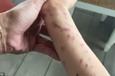 San Antonio Aquarium Incident Sparks Safety Concerns After Child Injured by Octopus